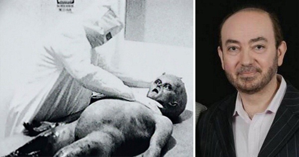 Autopsia dell’alieno di Roswell: la grande beffa 30 anni dopo