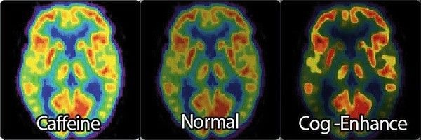 ESL, potrebbe essere introdotto il test anti-doping