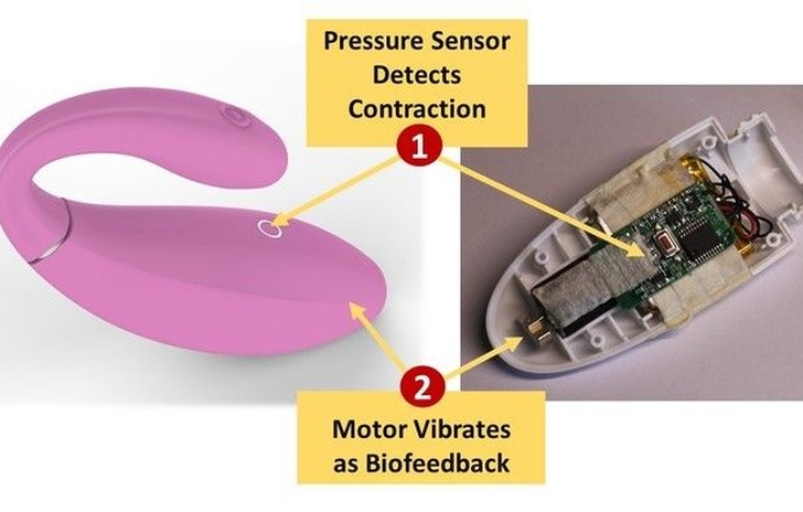 Un kickstarter per un controller pelvico