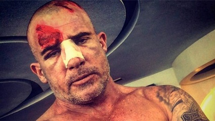 Dominic Purcell ferito gravemente sul set di Prison Break