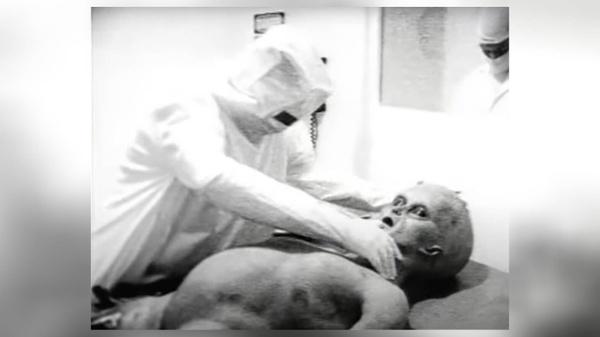 Autopsia dell’alieno di Roswell: la grande beffa 30 anni dopo