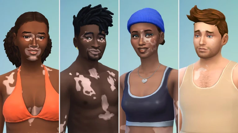 The Sims 4 implementa la Vitiligine